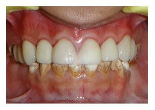 Cosmetic Dentist Gurgaon Cosmetic Dentist Gurgaon