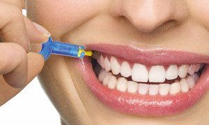 Interdental Brushing Interdental Brushing