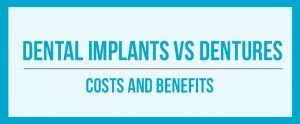Dental Implants Or Dentures