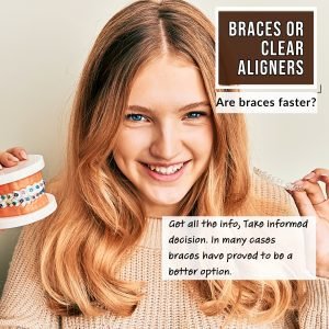 Braces vs Aligners