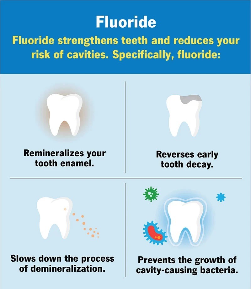 Fluoride Treatment