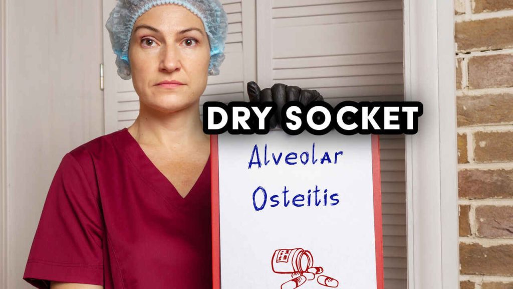 Dry Socket Treatment